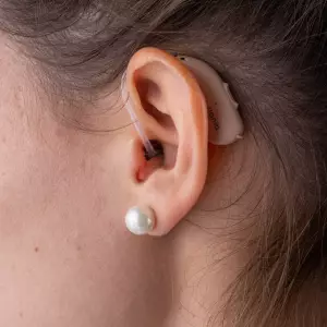 Signia Intuis M 4.1 galéria